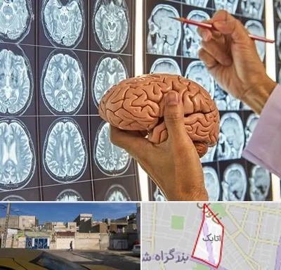 دکتر فوق تخصص جراح مغز و اعصاب در اتابک
