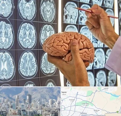 دکتر فوق تخصص جراح مغز و اعصاب در شمال شرق تهران