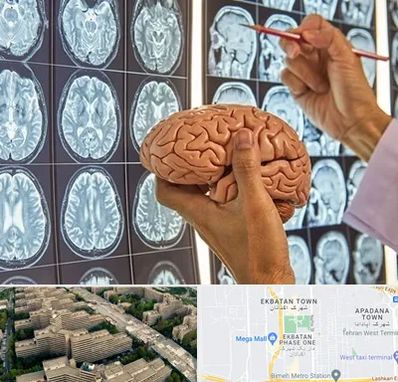 دکتر فوق تخصص جراح مغز و اعصاب در اکباتان 