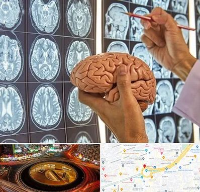 دکتر فوق تخصص جراح مغز و اعصاب در میدان ولیعصر 