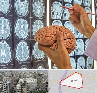 دکتر فوق تخصص جراح مغز و اعصاب در آذری