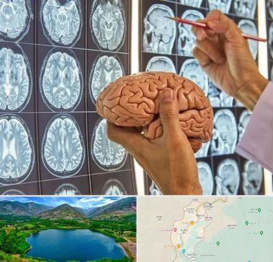 دکتر فوق تخصص جراح مغز و اعصاب در رودبار