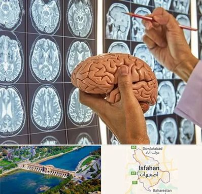 دکتر فوق تخصص جراح مغز و اعصاب در اصفهان
