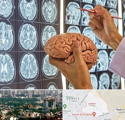 دکتر فوق تخصص جراح مغز و اعصاب در عظیمیه کرج 