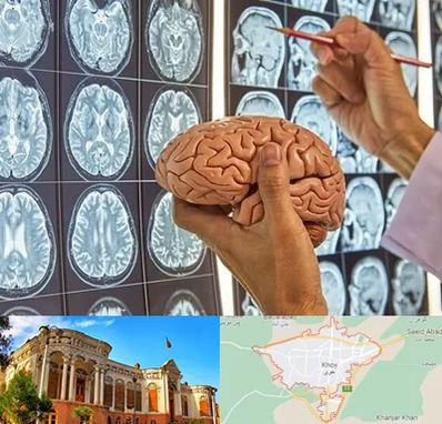 دکتر فوق تخصص جراح مغز و اعصاب در خوی