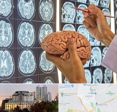 دکتر فوق تخصص جراح مغز و اعصاب در فرشته 