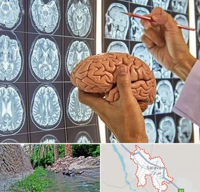 دکتر فوق تخصص جراح مغز و اعصاب در سراوان