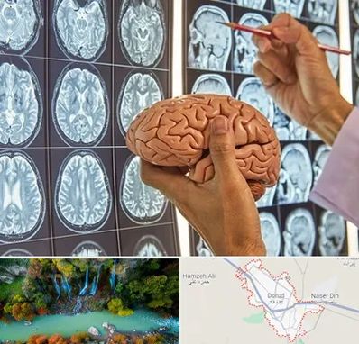 دکتر فوق تخصص جراح مغز و اعصاب در دورود