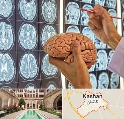 دکتر فوق تخصص جراح مغز و اعصاب در کاشان