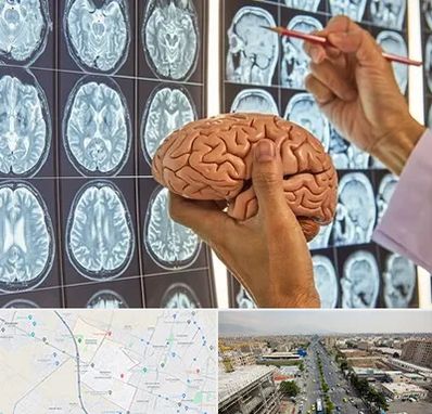 دکتر فوق تخصص جراح مغز و اعصاب در حصارک کرج 