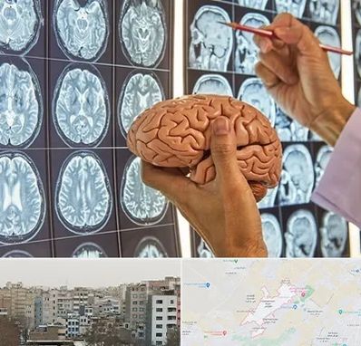 دکتر فوق تخصص جراح مغز و اعصاب در محمد شهر کرج 