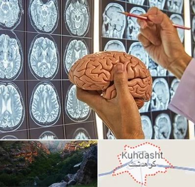 دکتر فوق تخصص جراح مغز و اعصاب در کوهدشت