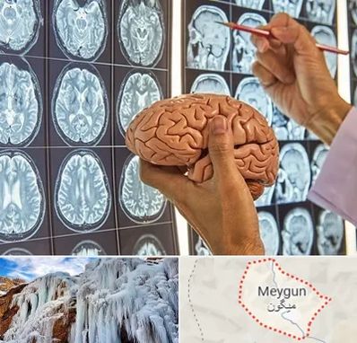 دکتر فوق تخصص جراح مغز و اعصاب در میگون