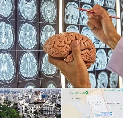 دکتر فوق تخصص جراح مغز و اعصاب در ولنجک 