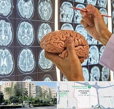 دکتر فوق تخصص جراح مغز و اعصاب در آپادانا