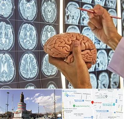 دکتر فوق تخصص جراح مغز و اعصاب در کارگر جنوبی 