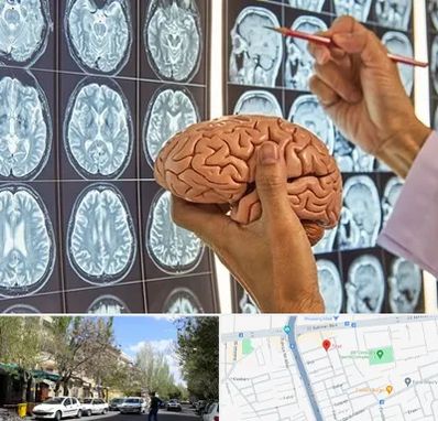دکتر فوق تخصص جراح مغز و اعصاب در کوی فیروز تبریز