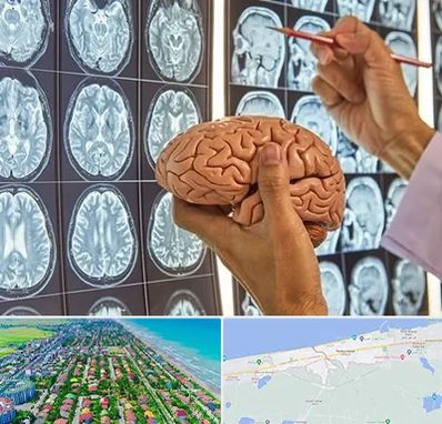 دکتر فوق تخصص جراح مغز و اعصاب در فریدونکنار