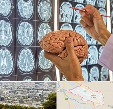 دکتر فوق تخصص جراح مغز و اعصاب در یاسوج