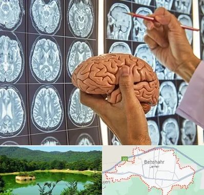 دکتر فوق تخصص جراح مغز و اعصاب در بهشهر