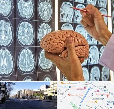 دکتر فوق تخصص جراح مغز و اعصاب در خیابان ملاصدرا شیراز 