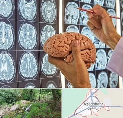 دکتر فوق تخصص جراح مغز و اعصاب در آزادشهر