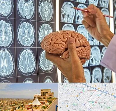 دکتر فوق تخصص جراح مغز و اعصاب در هاشمیه مشهد 