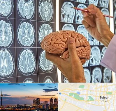 دکتر فوق تخصص جراح مغز و اعصاب در غرب تهران 