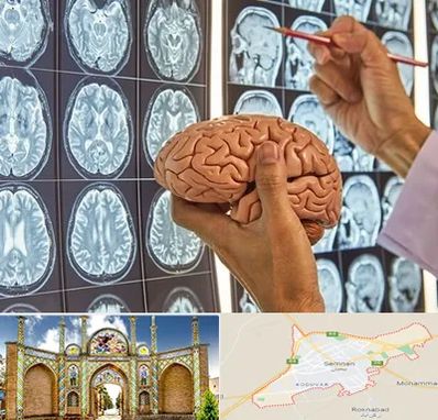دکتر فوق تخصص جراح مغز و اعصاب در سمنان