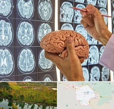 دکتر فوق تخصص جراح مغز و اعصاب در بهبهان