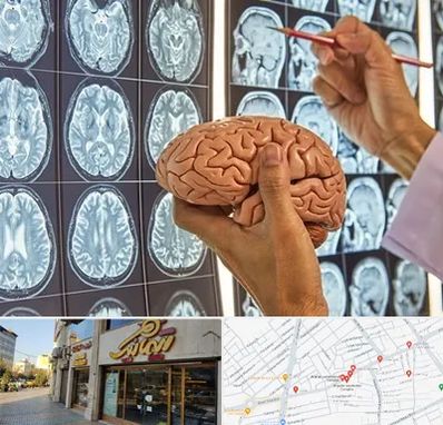 دکتر فوق تخصص جراح مغز و اعصاب در عطاران قم