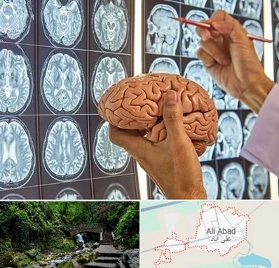 دکتر فوق تخصص جراح مغز و اعصاب در علی آباد کتول