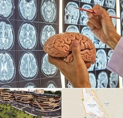 دکتر فوق تخصص جراح مغز و اعصاب در شاهین شهر