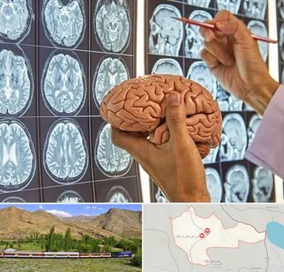 دکتر فوق تخصص جراح مغز و اعصاب در خاش