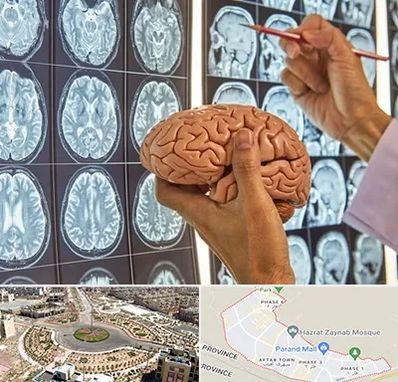 دکتر فوق تخصص جراح مغز و اعصاب در پرند