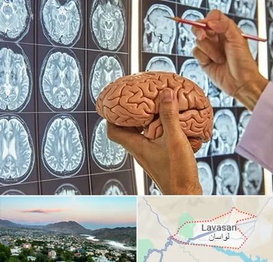 دکتر فوق تخصص جراح مغز و اعصاب در لواسان