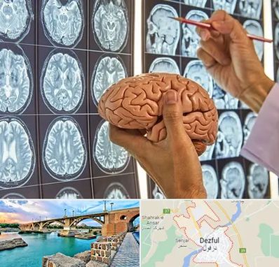 دکتر فوق تخصص جراح مغز و اعصاب در دزفول