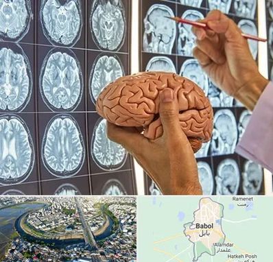 دکتر فوق تخصص جراح مغز و اعصاب در بابل