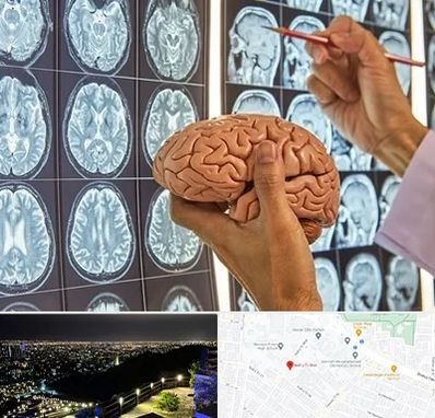 دکتر فوق تخصص جراح مغز و اعصاب در هفت تیر مشهد 