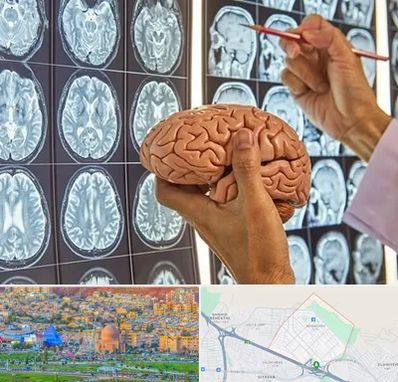 دکتر فوق تخصص جراح مغز و اعصاب در رشدیه تبریز