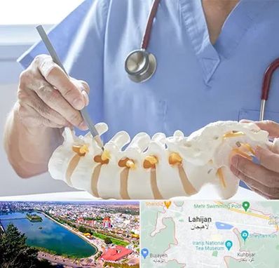 دکتر ستون فقرات در لاهیجان