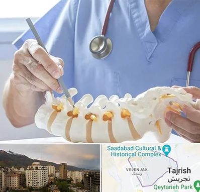 دکتر ستون فقرات در زعفرانیه 