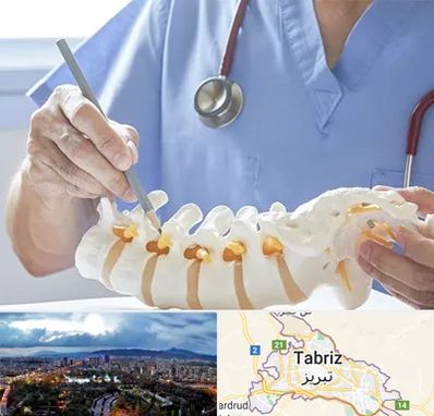 دکتر ستون فقرات در تبریز