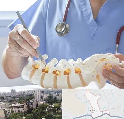 دکتر ستون فقرات در اوین