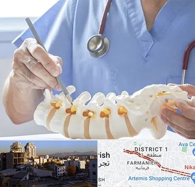 دکتر ستون فقرات در فرمانیه 