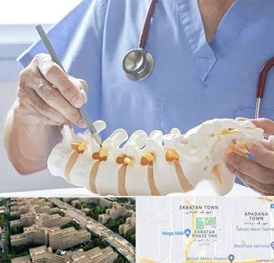 دکتر ستون فقرات در اکباتان 