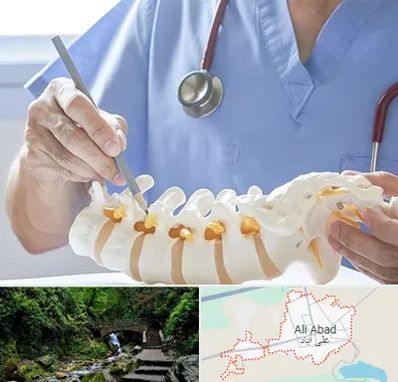 دکتر ستون فقرات در علی آباد کتول