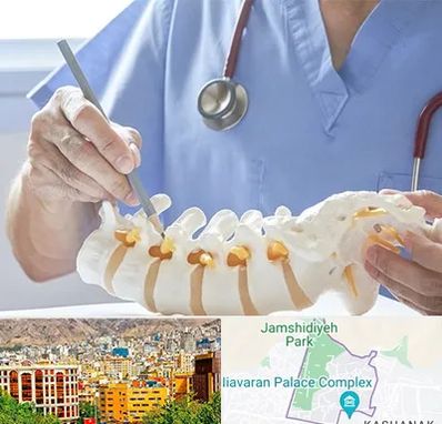 دکتر ستون فقرات در نیاوران 