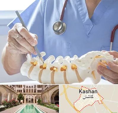 دکتر ستون فقرات در کاشان