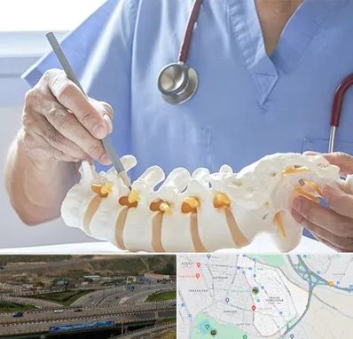 دکتر ستون فقرات در یاغچیان تبریز